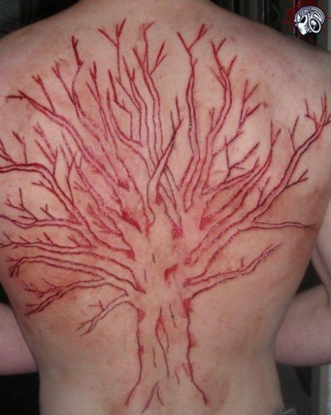 grande albero scarificazione pelle sulla schiena