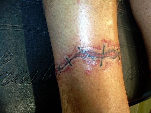 Tattoo von grob genähter Wunde in der Knöchelgegend