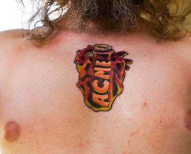 Acme tatouage sur la poitrine