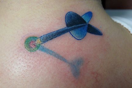 el tatuaje 3D de un dardo azul en el cuello