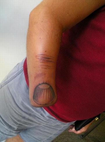 Ungewöhnliches Tattoo bei fehlender Hand