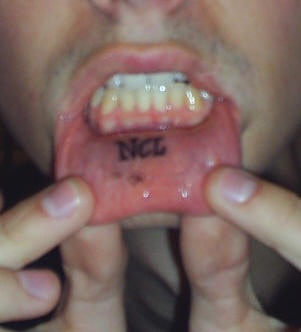 Lip tattoo, ncl, black brief word