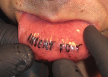 Tatuaggio sul labbro &quotINSERT FOR" a lettere piccole