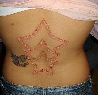 Large skin scarification stars on back