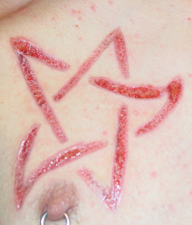 Skin scarification pentagram on nipple