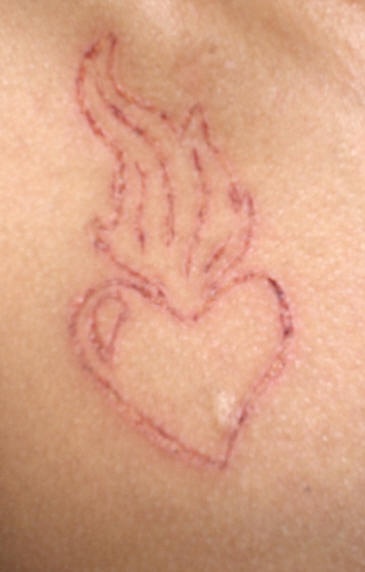 Skin scarification sacred heart
