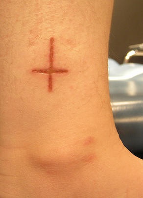 Skin scarification saint peter cross