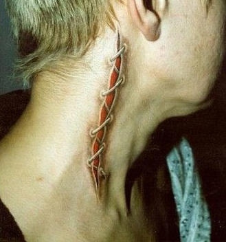 Skin rip stitches on neck tattoo