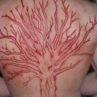 grande albero scarificazione pelle sulla schiena