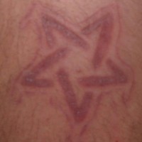 Skin scarification turned pentagram
