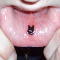 Tatuaje en el labio inferior, negro grueso signo