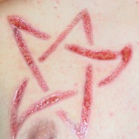 Skin scarification pentagram on nipple