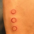 Tres círculos cortados en la piel
