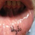 Tatuaggio sul labbro 