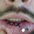Tatuaje en el labio, tres letras gruesas, xxx