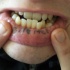 Tatuaggio sul labbro 